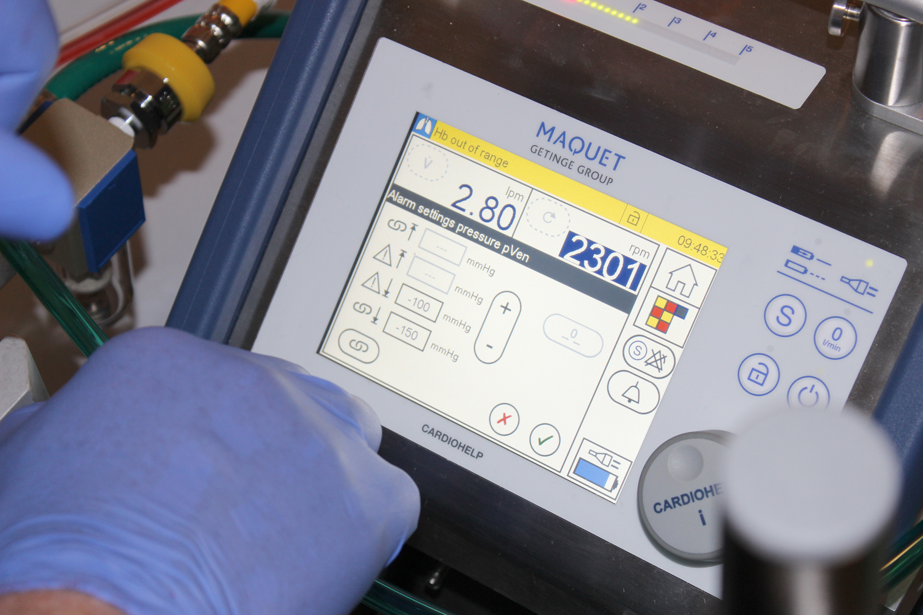 ECMO
