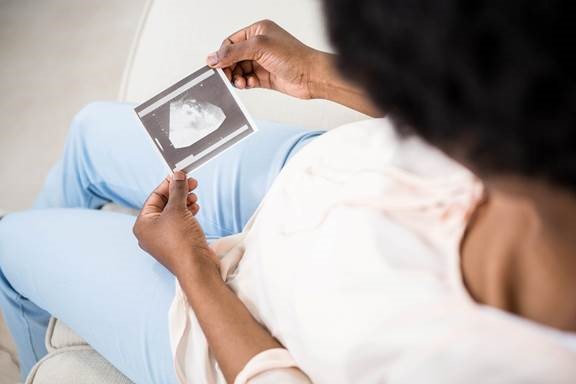 woman looking at ultrasound