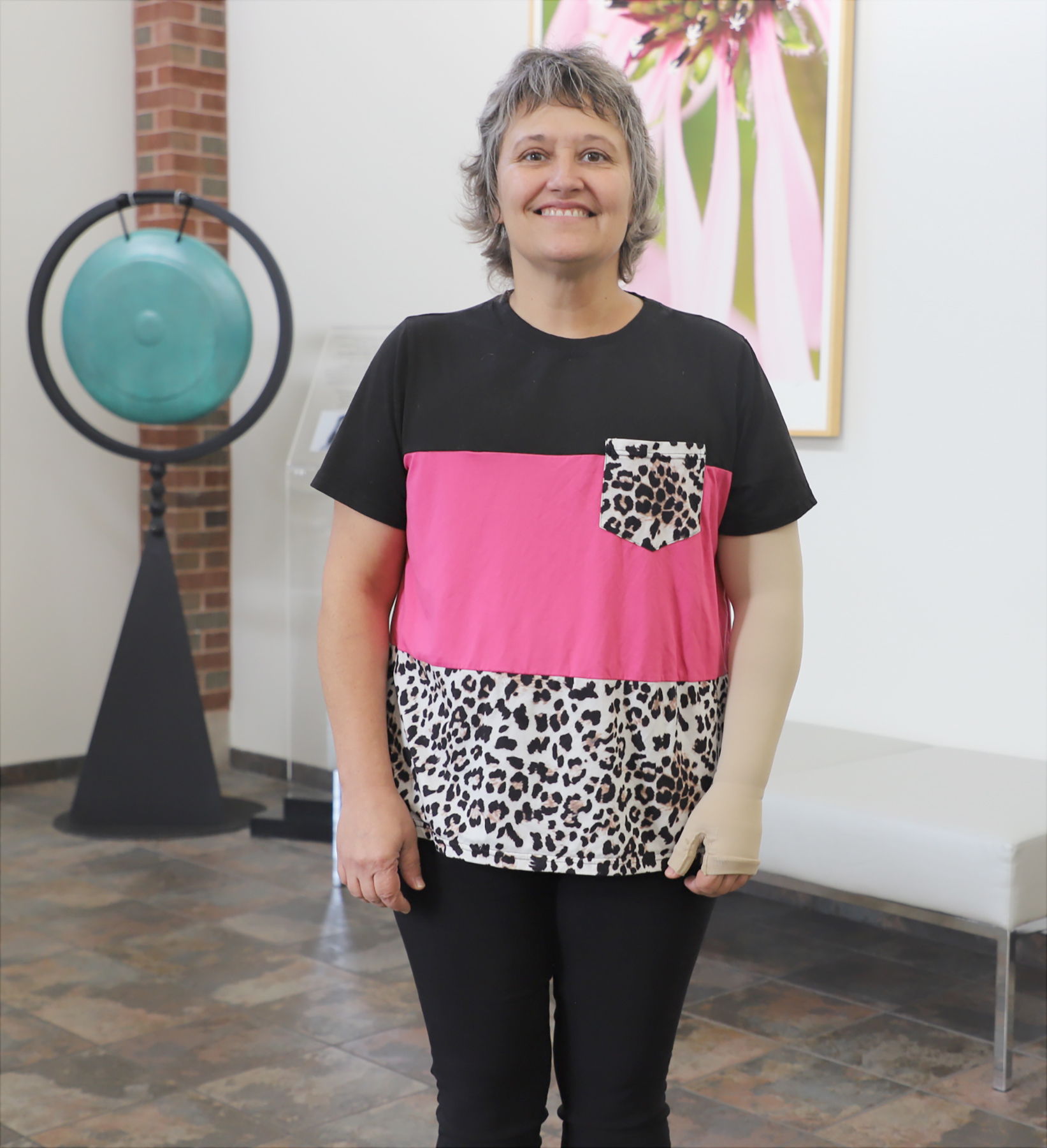 April Folweiler Lymphedema Survivor